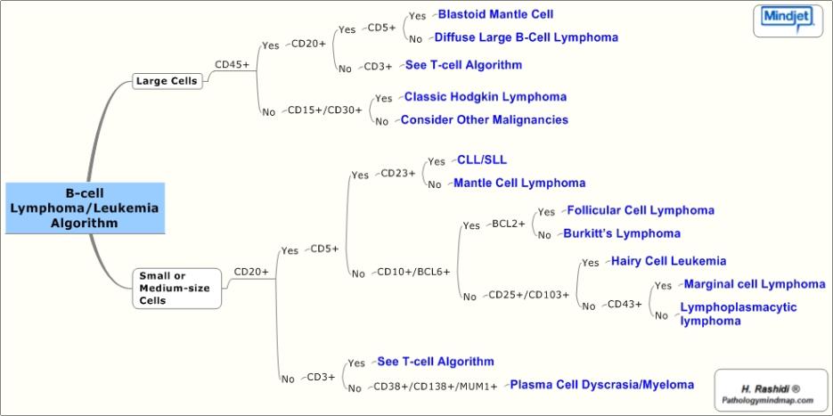 B-cell Lymphomas and Leukemias Immunoprofile Algorithm 